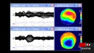 Semaine du cerveau dans les universités suisse: mise au point sur les connaissances sur le cerveau avec l'exemple de la stimulation par la musique