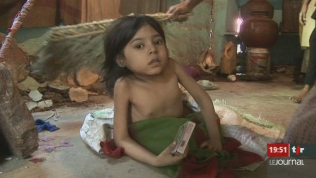 Enfant souffrant de malformations à Bhopal en 2009. [RTS]
