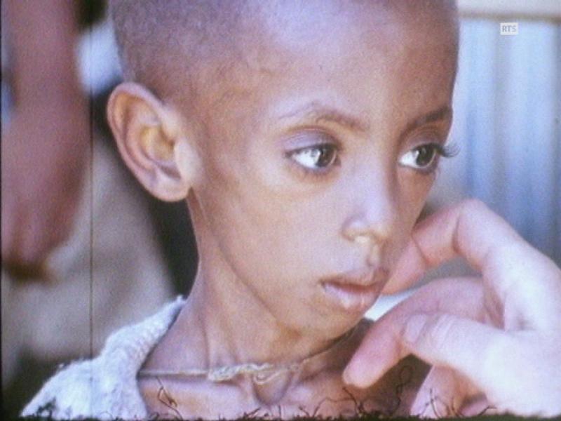 Enfant souffrant de malnutrition en Ethiopie en 1973. [RTS]