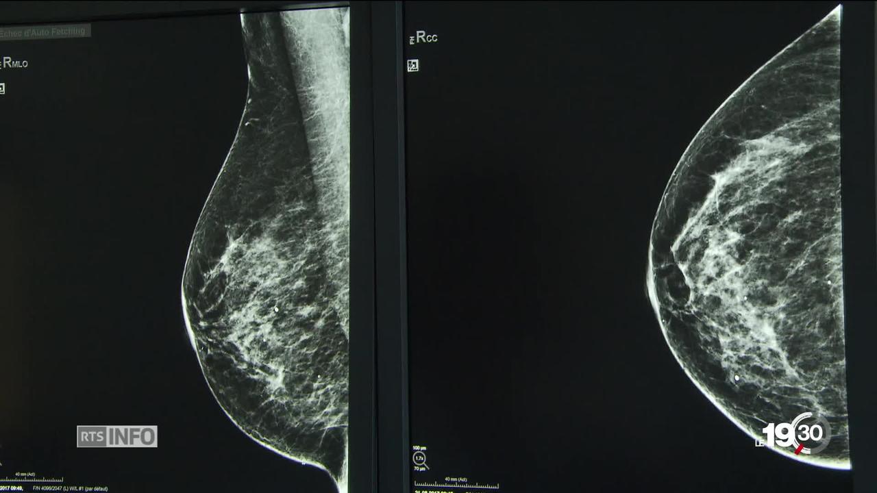 Cancer du sein, découverte majeure: Les chimiothérapies peuvent être évitées dans de nombreux cas