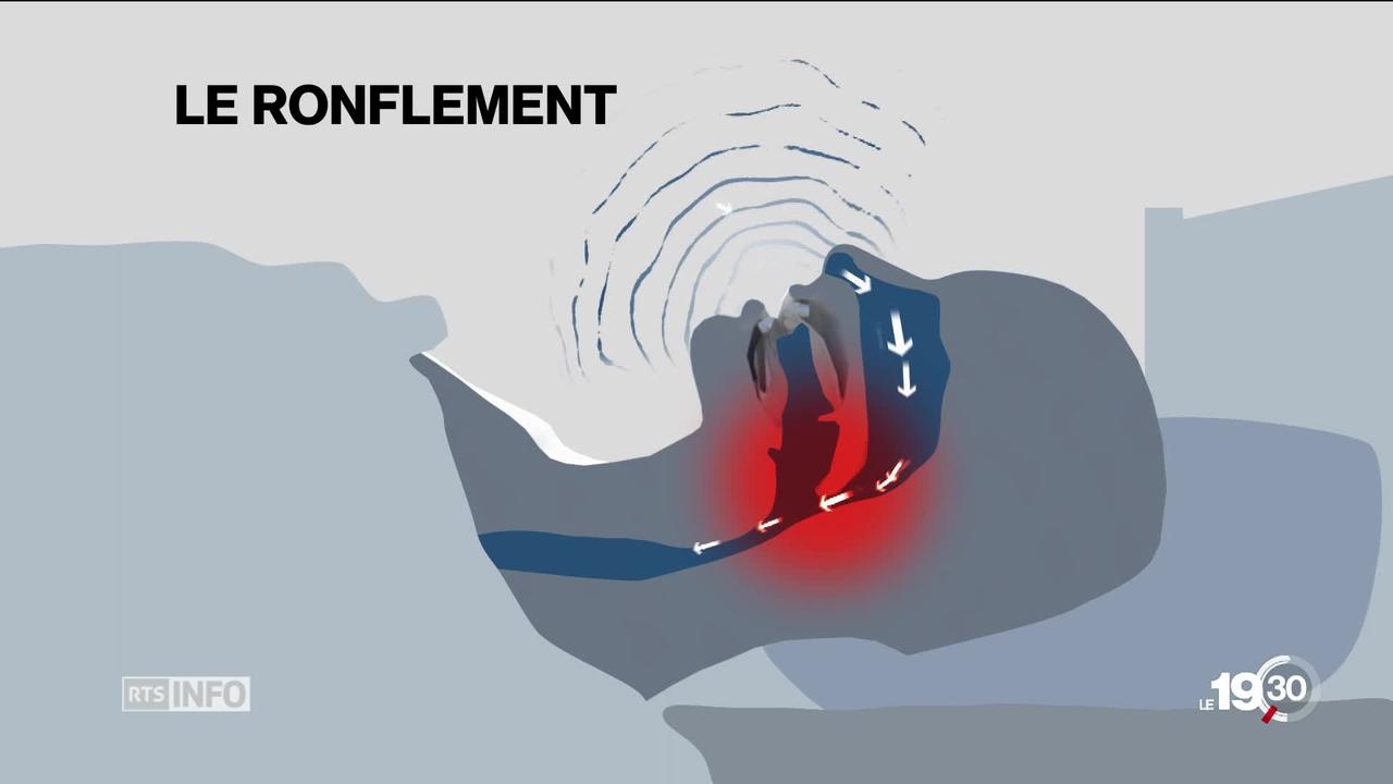 Sommeil: un lit piloté par reconnaissance vocale pour combattre les ronflements