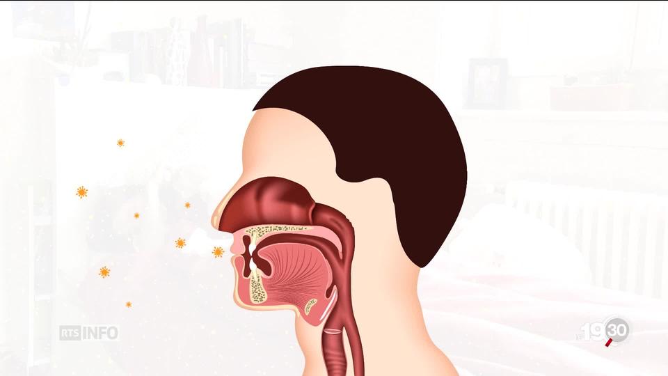 L'épidémie de grippe progresse rapidement ces dernières semaines en Suisse