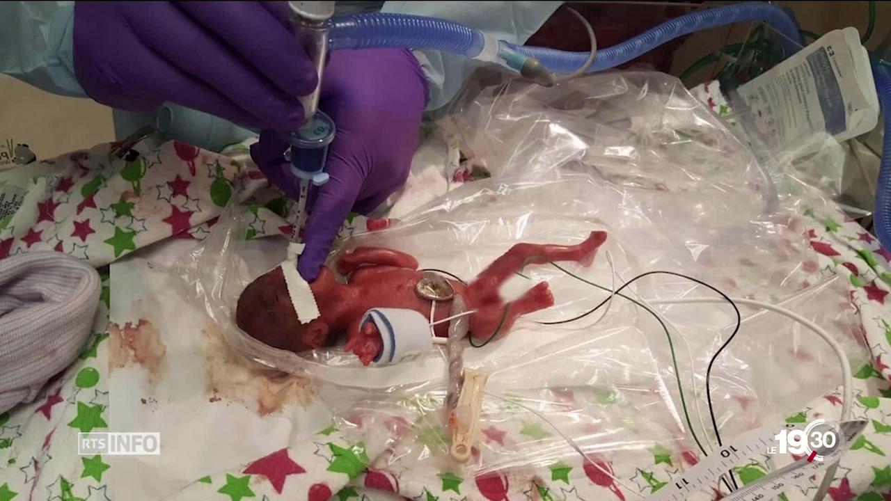 245 grammes à la naissance: ce bébé prématuré est miraculé