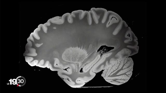 "Cinq nouvelles du cerveau": le documentaire de Jean-Stéphane Bron sur l'intelligence artificielle