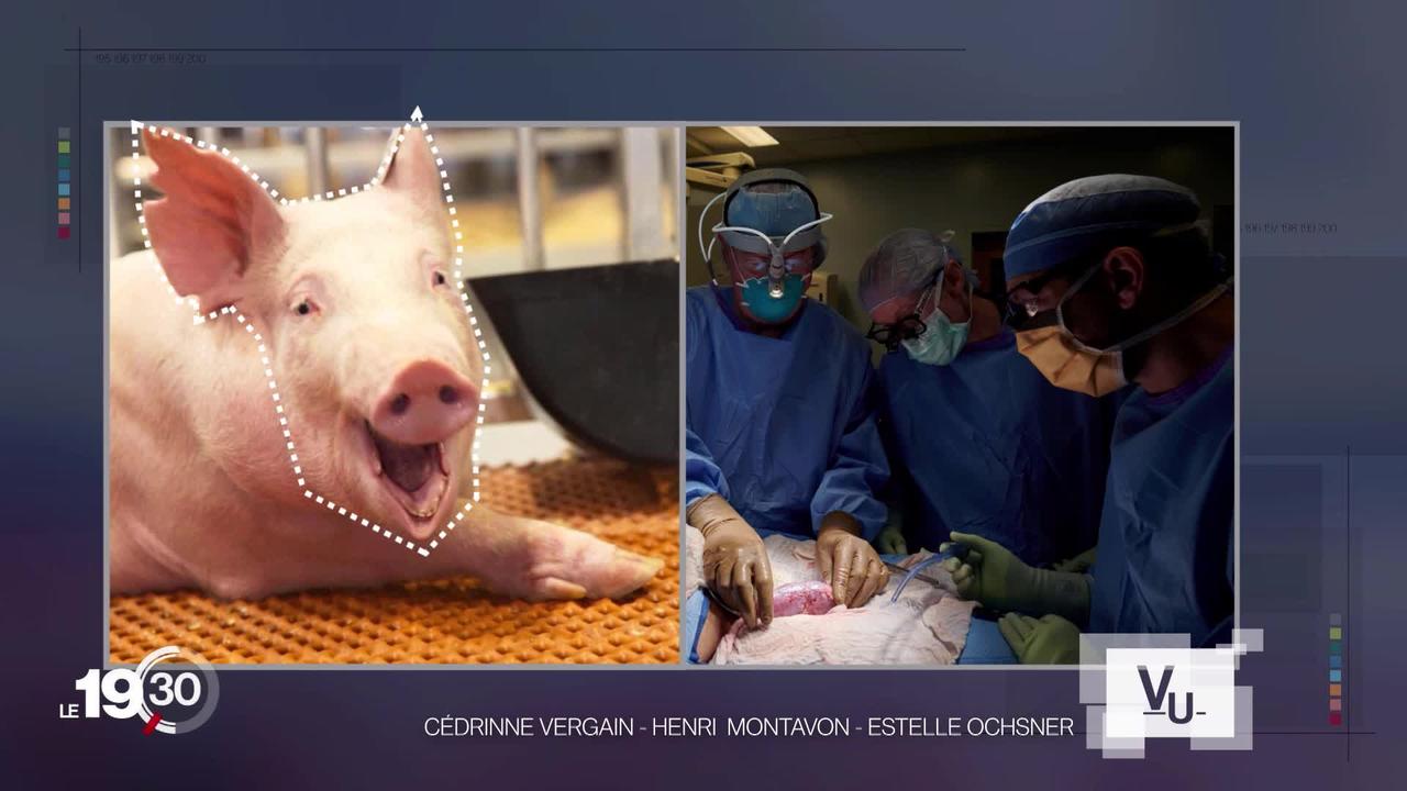 Des scientifiques américains ont réussi à faire fonctionner sur un humain le rein d'un porc génétiquement modifié.