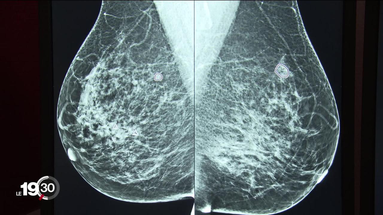 Cancer du sein: l'espoir dans les traitements
