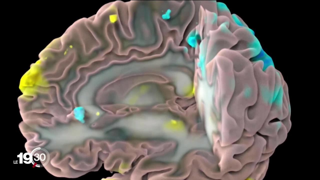 Des chercheurs américains sont parvenus à décoder les pensées en mots lorsqu'elles naissent dans le cerveau