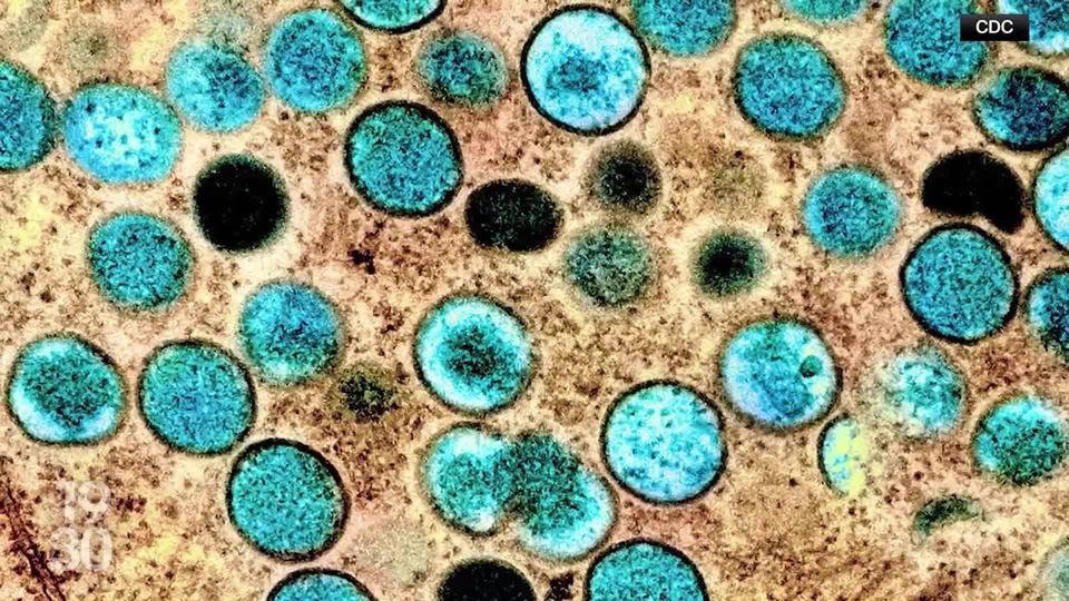 Le point sur le virus du mpox, quelques jours après le déclenchement du plus haut niveau d’alerte sanitaire par l'OMS