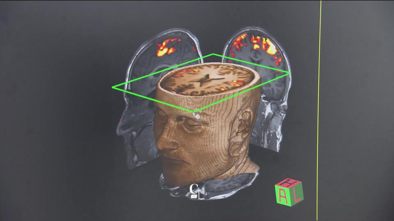 La rubrique vrai-faux de ce jour nous questionne sur les capacités de notre cerveau, cet organe si particulier et si mystérieux