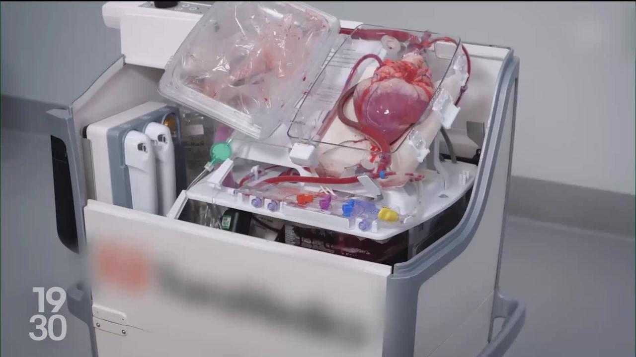 2023 est une année record en termes de dons d’organes, grâce à une meilleure identification des donneurs potentiels.